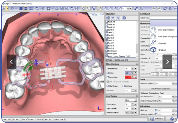 Scheu OnyxCeph 3 / CA Smart 3D 2.0