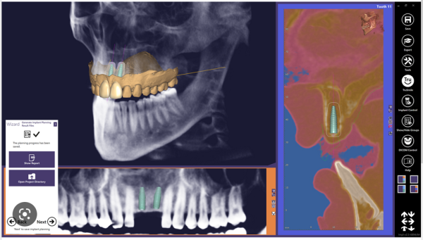 Exoplan Core Bundle inkl. Guide Creator Flex