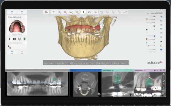 Implant Studio Software