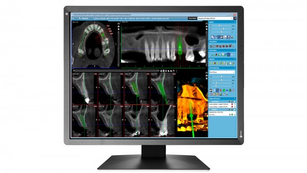 EIZO MX217-HB RadiForce (RK 6)