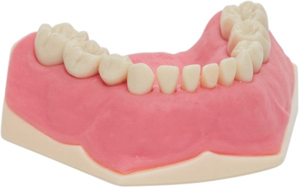 Kinderzahnmodell AK-6